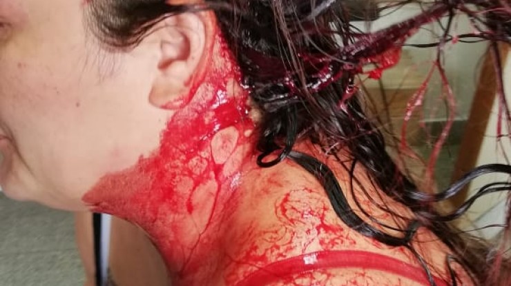 Golpeó a su pareja con un arma y se fugó